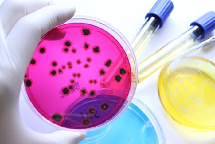 Cómo se realiza el análisis microbiológico de carnes y productos cárnicos 2 analisis microbiologico